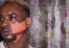 Ouzin Keïta agressé par son «khessal »: Les images de la torture