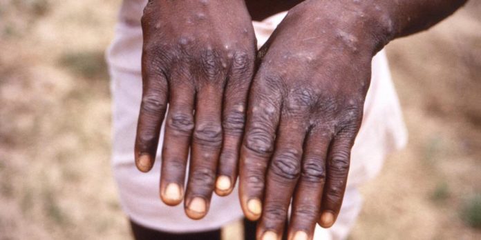 A3396659-ADE3-4715-8756-33F97DEA462E